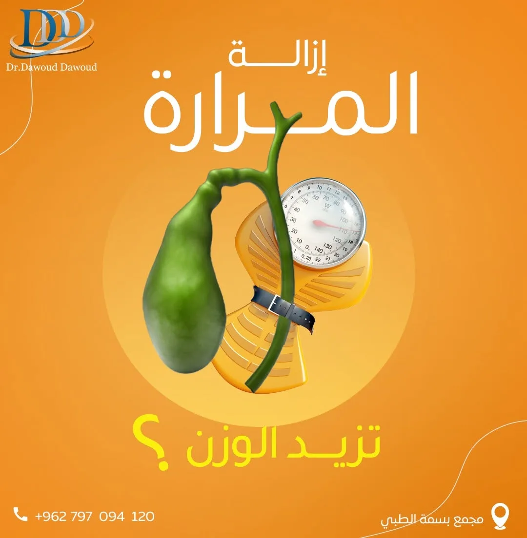 استئصال المرارة بالمنظار في عمان مع الدكتور داوود داوود