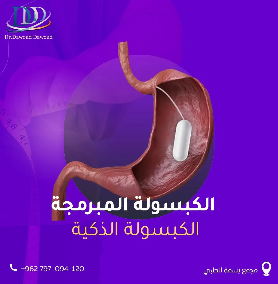 الكبسولة الذكية لعلاج السمنة: لمن تناسب؟