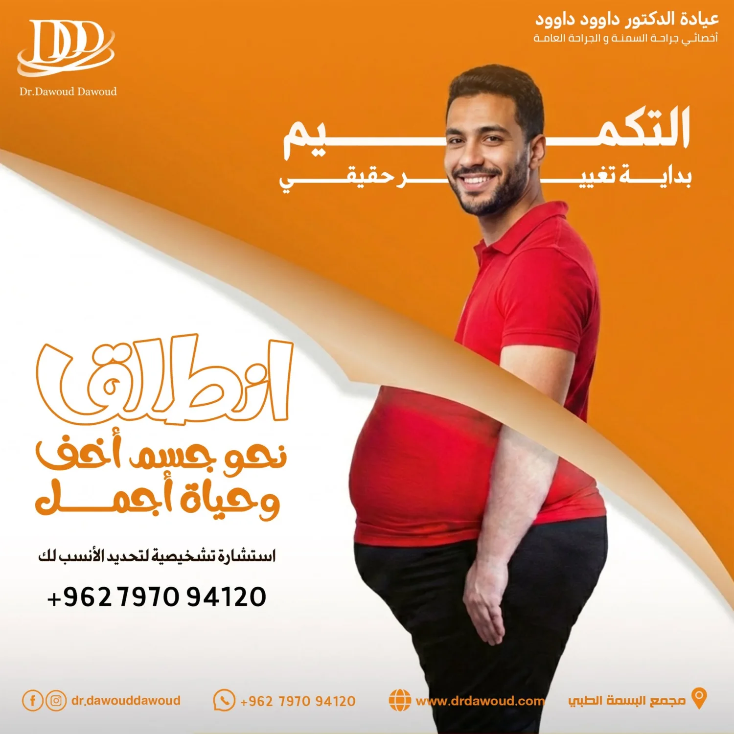 تكميم المعدة في عمان مع الدكتور داوود داوود
