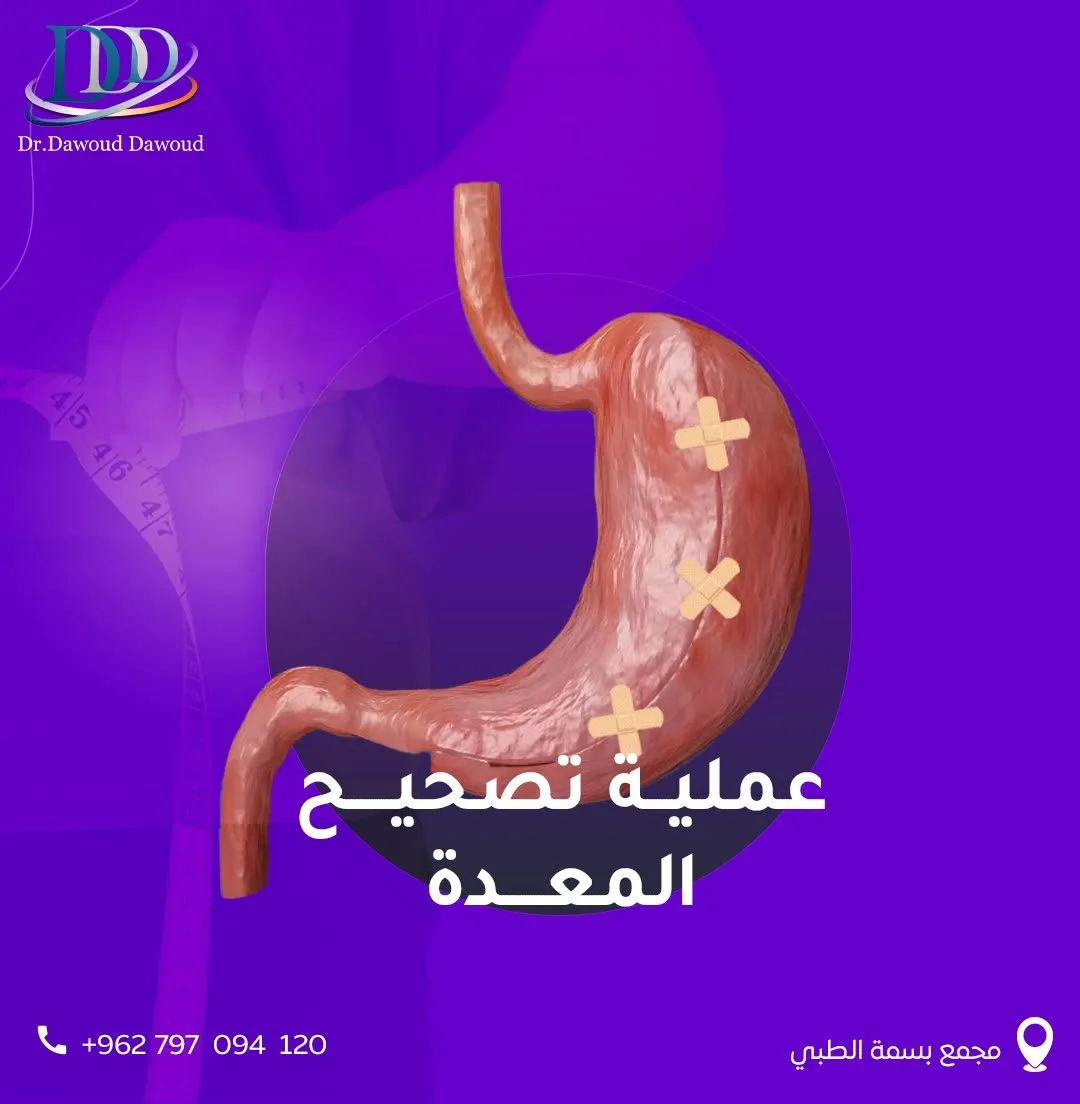 تصحيح عمليات السمنة السابقة